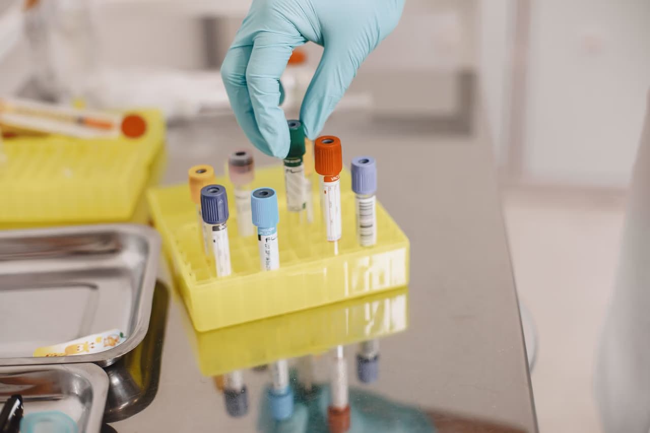 Laboratory technician wearing blue gloves handles a sample tube in a yellow rack.